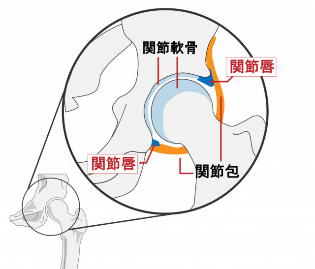 股関節の写真